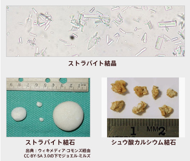 ストラバイト結晶